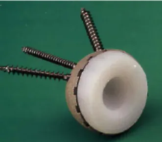 Figure 1.5 : cupule blindée à revêtement micro- micro-poreux 
