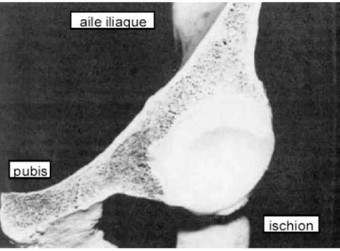 Figure 5.17 : Coupe frontale d'une cupule implantée dans une pièce anatomique.  