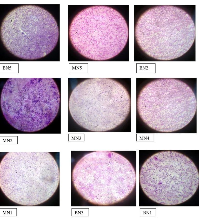 Figure N°8 : Aspects microscopique des souches sélectionnées Observation au microscope  photonique et à l'immersion (x100)A