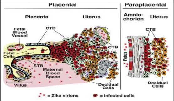 Figure 2. Infected placental cells by ZIKV presented with red color (Tabata et al., 2016)