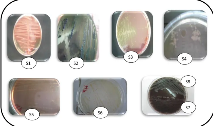 Figure 09 : Aspect  macroscopique des différentes souches sur les milieux gélosées  ensemencées à partir de l’enrichissement du  prélèvement P1 