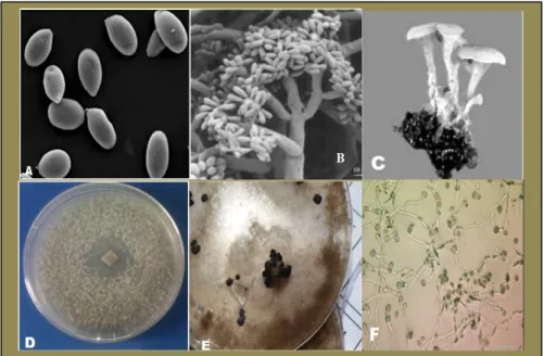 Figure  2  -Conidies  observés  en  utilisant  un  microscope  électronique  à  balayage  (A)