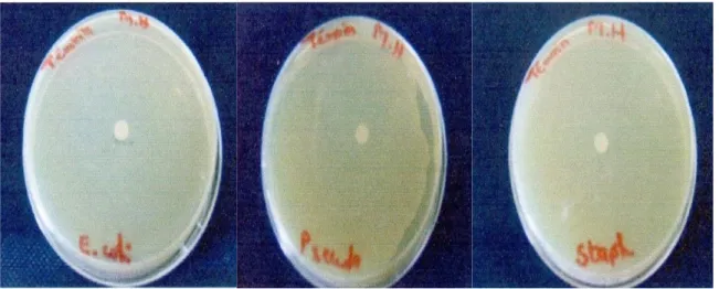 Figure 14 : photos des témoins
