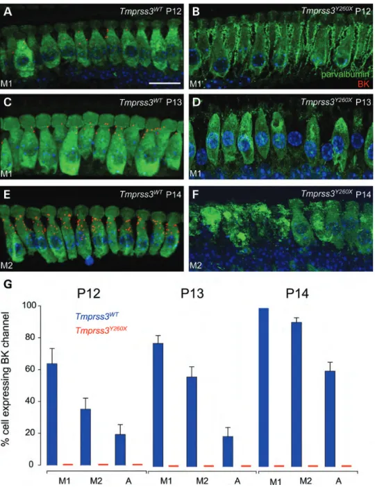 Figure 4. Kcnma1 channels are no longer expressed in the neck of IHCs of Tmprss3 Y260X -mutant mice