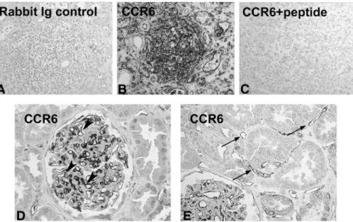 Fig. 1. Establishment of the anti-CCR6 antibody and expression in normal human kidney
