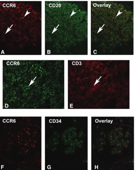 Fig. 2. Double immunofluorescence for CCR6. Double Immunofluorescence was performed on tissue sections from an allograft nephrectomy