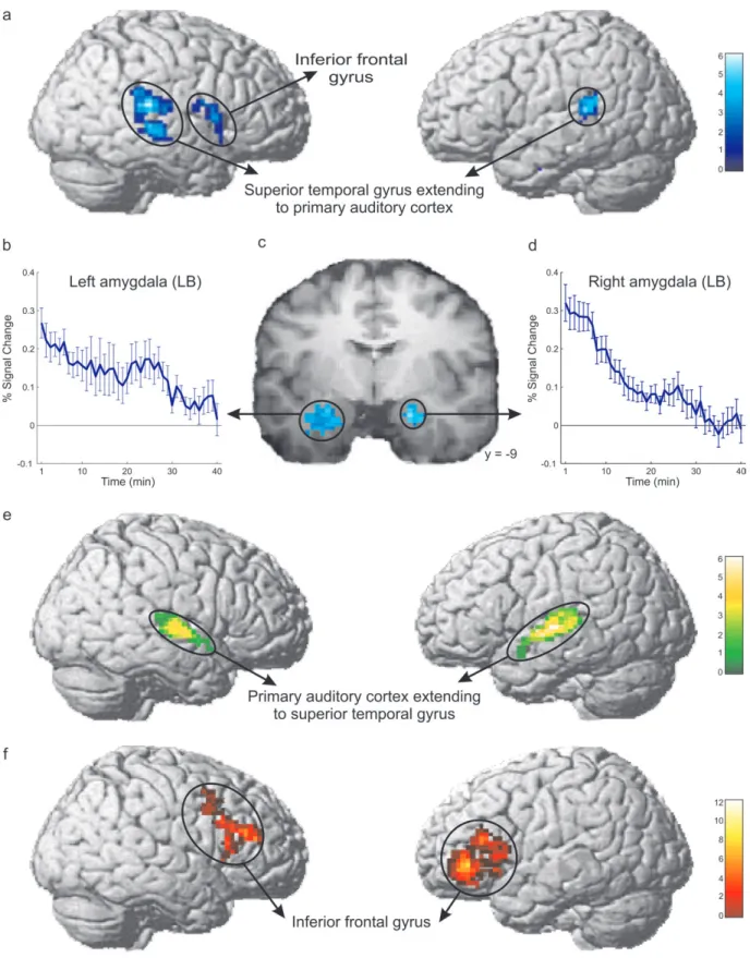Figure 3. (a) Long-term habituation (occurring within 43 min) was observed in the right and left nonprimary auditory cortex and in the right inferior frontal cortex (including the right hemisphere Broca’s homologue)