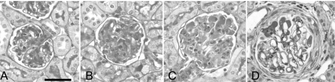 Fig. 3. Histology of glomeruli in control (A) and in glomerulonephritic (B, day 4; C, day 8; D, day 14)