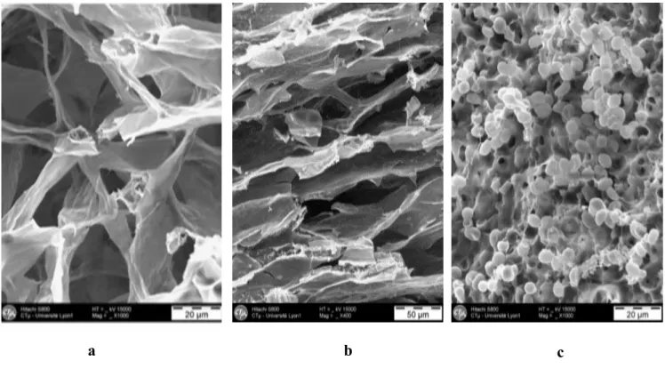 Figure III.2 : Images (MEB) des microstructures : (a) chapeau, (b) pied et (c) lamelle                           d'A