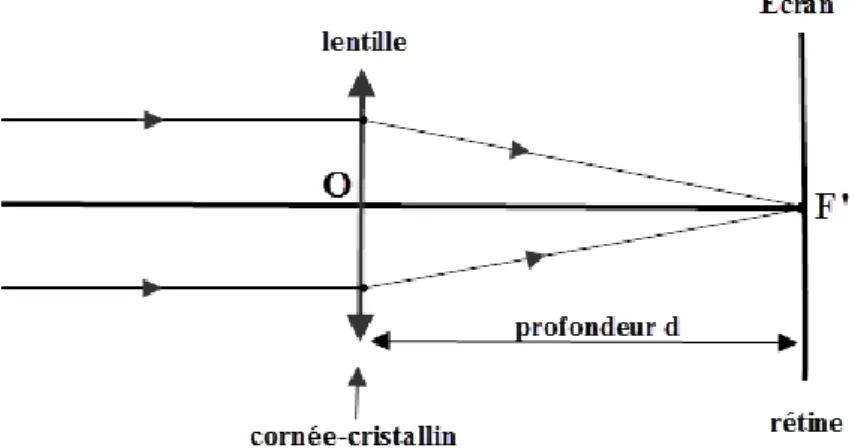 Figure 1: Schéma représentatif d'un œil normal 