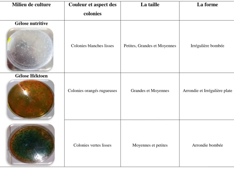 Tableau 4. Résultat de lecture macroscopique des échantillons N° 3, 5, 6,7, 9 et 11.  