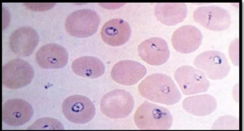 Figure 7: Frottis de placenta infesté (Rogerson et al.,  2007).   