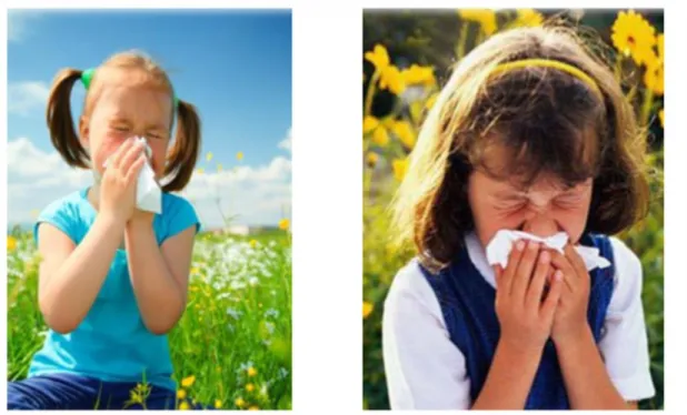 Figure 3 : Les manifestations cliniques les plus communes dans la rhinite allergique [4]