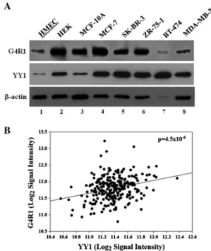 Figure 9. Studies of G4R1 and YY1 expression in breast cancer cell lines and patient samples