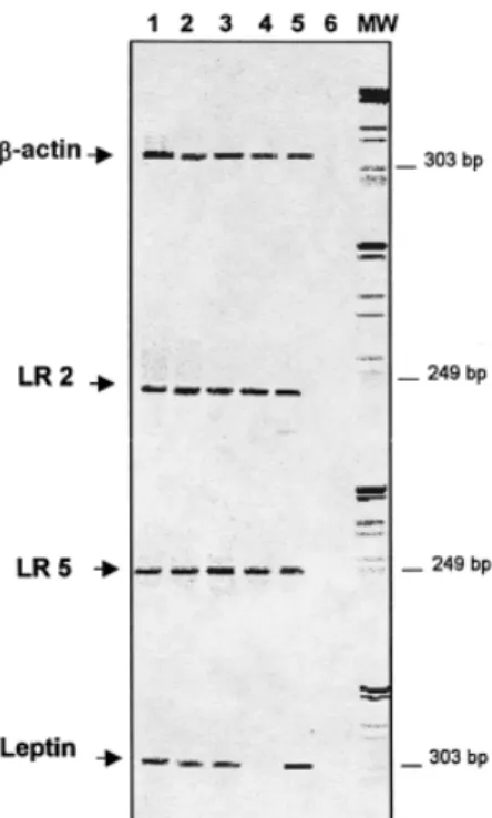 Figure 2. Reverse transcription–polymerase chain reaction (RT–PCR) expression analysis of Leptin Receptors (LR) splice variants and leptin in human placenta