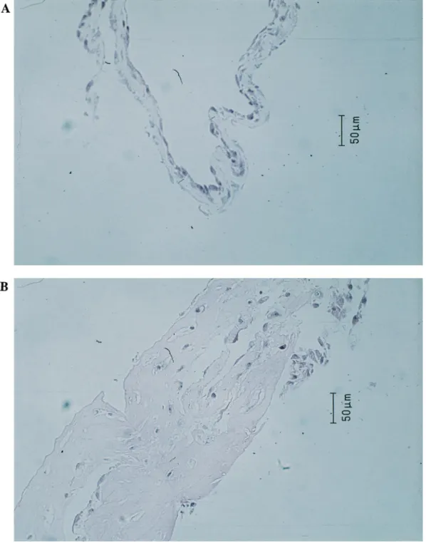Fig. 1. Light microscopy pictures of cell ®brin gel cultured in different aprotinin concentration