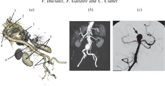 Figure 1. (Colour online) (a) Three-dimensional angiography of an aorta without aneurysm: