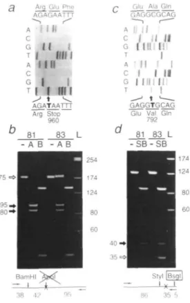 Figure 4. UV sensitivity of transfected lymphoblastoid XPG83 cells from patient XP125LO