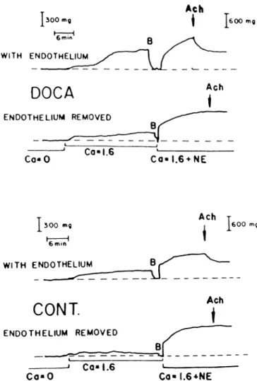 FIGURE 7. Endothelium-dependent contractions to stretch in  the aorta of normotensive (CONT.) and hypertensive rats (DOCA)