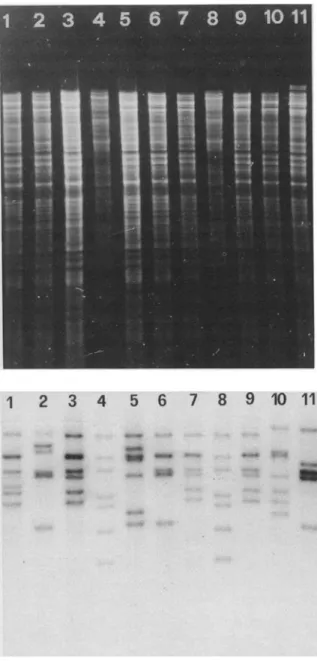 Figure 1. Restriction endonuclease patterns (top) and ribosomal RNA gene restriction patterns (bottom) of S.