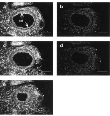 Fig. 2. Specificity of 125 I-AT-binding to aHSPGs in ovary cryosections: