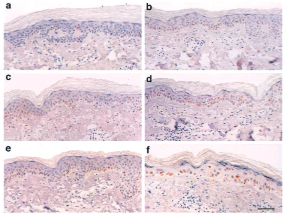 Fig. 2. Immunohistochemically stained sections of skin, displaying the various layers of the epidermis and the upper part of underlying  der-mis