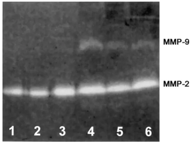 Figure 1. Representative zymography of cerebrospinal fluid (CSF) samples from uninfected control rabbits (lanes 1–3) and rabbits with coccidioidal meningitis (lanes 4–6) 7 days after infection