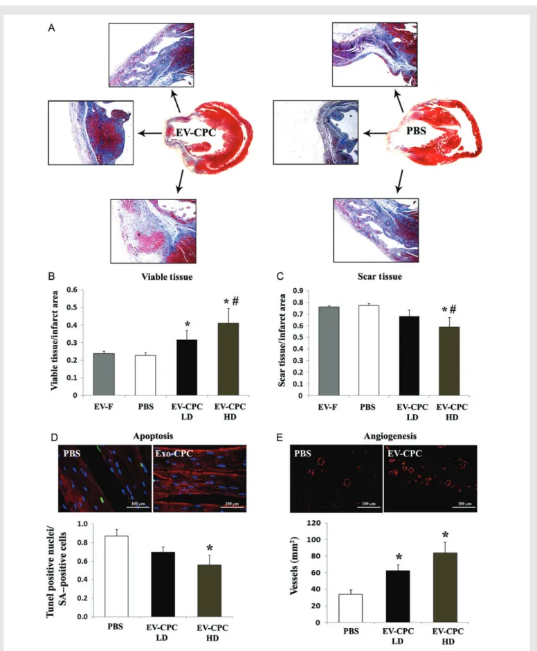 Figure 7 Morphometric analyses of infarcted rat hearts. (A) Masson’s trichrome-stained sections of EV-CPC- (left) and PBS-injected hearts (right)