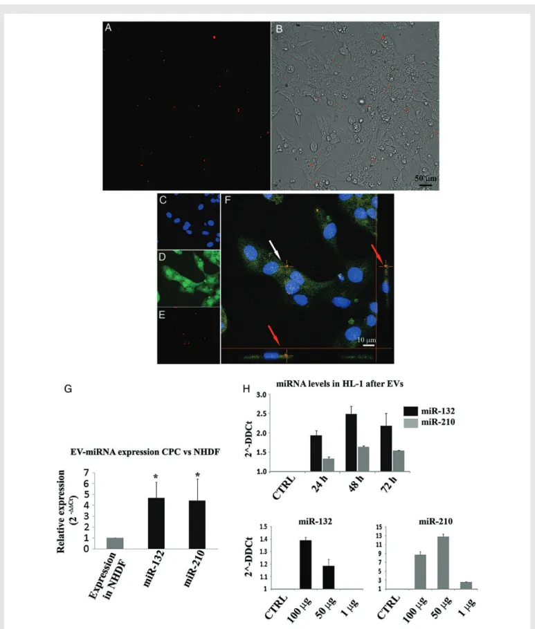 Figure 4 Uptake of EVs from CPCs (EV-CPC) by HL-1 cardiomyocytic cells and changes in the intracellular concentrations of some of the miRNAs enriched in EV-CPC