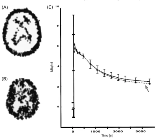 Fig. 1 The majority of the time–activity curves extracted by cluster analysis from the dynamic [ 11 C](R)- C](R)-PK11195 PET data of a normal brain fell into two clusters, one localizing to extracerebal structures (A) and the other to healthy brain tissue 