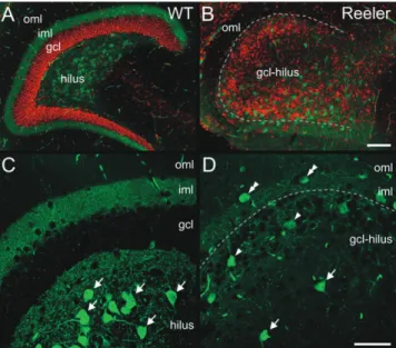 Figure 1. Immunofluorescent staining for CR reflects the disrupted layering of the reeler DG