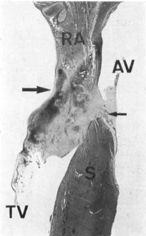 Fig. 5.  Cut  through  the  AV  border of a dog heart with total  AV  block, two  months after the  block production