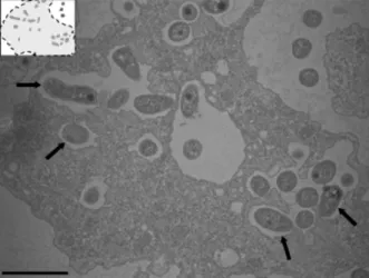 Fig. 6. Bosea sequanensis (arrows) within Acanthamoeba castellannii, as seen by electron microscopy