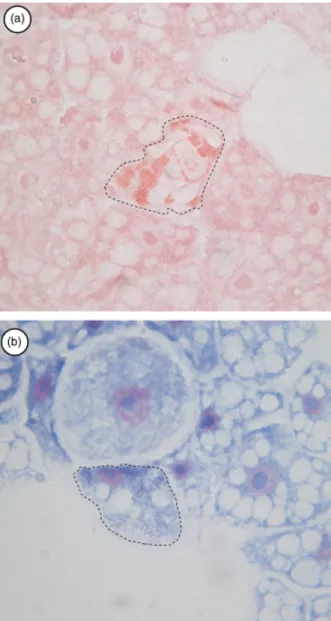 Fig. 2. Legionella drancourtii, i.e. LLAP-12, within Acanthamoeba cas- cas-tellannii as seen by gram staining (a) and Diff-Quick staining (modified May–Gr ¨unwald Giemsa) (b), respectively