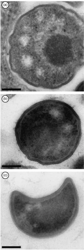 Fig. 3. Simkania negevensis within Acanthamoeba castellannii, as seen by electron microscopy 24 h postinfection