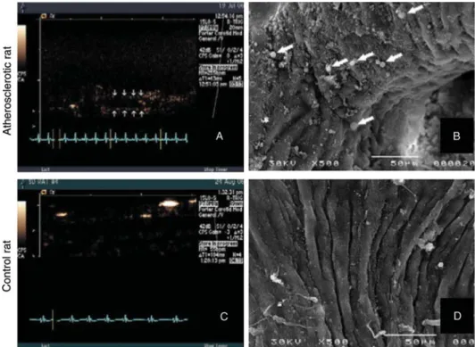 Figure 3 Ultrasound images at low mechanical index and scanning electron microscopy (SEM) of the aortic arch in an atherosclerotic rat (A, B) and a control rat (C, D) after intravenous injection of PESDA microbubbles