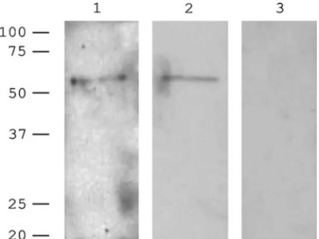 Fig. 7. Western blot of adult worm tegument