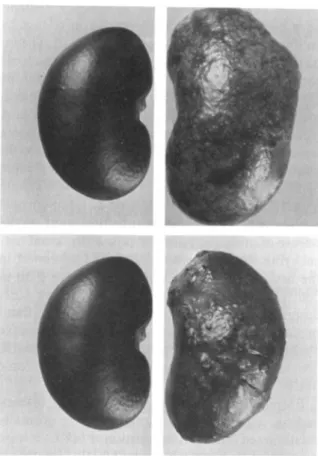 Figure 1. Control (left) and acutely pyelonephritic (right) kidneys from (top) untreated and (bottom)  neu-tropenic rats 