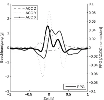 Tabelle 1 Mittlere maximale Korrelation zwischen einzelnen Beschleu- Beschleu-nigungskomponenten und der Störung im PPG-Signal bei sprunghaften Bewegungen in verschiedene Richtungen.