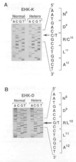 Figure 1. (A) Pedigree and PCR analysis of the EHK-E/S family. Males are represented by squares, females by circles and affected individuals by solid symbols