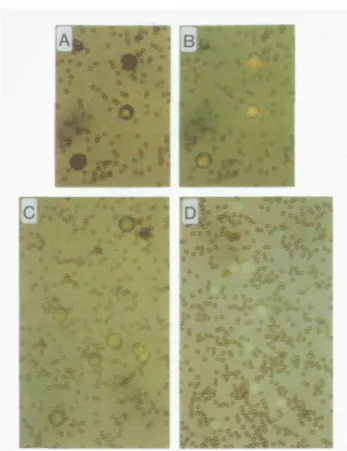 Fig. 2. Rosette formation. A20 cells were incubated with CD4-hC&gt;- beads; subsequently, the cells were stained with acridme orange The comparison of (A) light micrograph only versus (B) light micrograph overlaid by fluorescence micrograph reveals that mo
