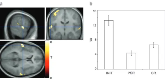 Figure 4. Follow-up contrast results. A cluster in the left superior temporal gyrus (BA22) exhibited reduced activation following repetition of acoustically identical objects (PSR condition; perceptual priming) and for semantically related objects (SR cond