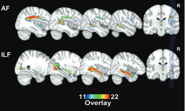 Figure 6. Connectivity probabilities between major white-matter bundles and face- face-responsive regions (analysis 3)