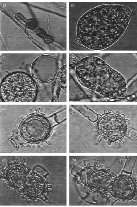 Fig. 1. Asexual and sexual reproductive bodies of Pythium spiculum: (a) peanut-shaped  inter-calary hyphal bodies; (b, d) interinter-calary elongated hyphal bodies; (c) spherical hyphal body; (e, f) spherical and intercalary ornamented oogonia;