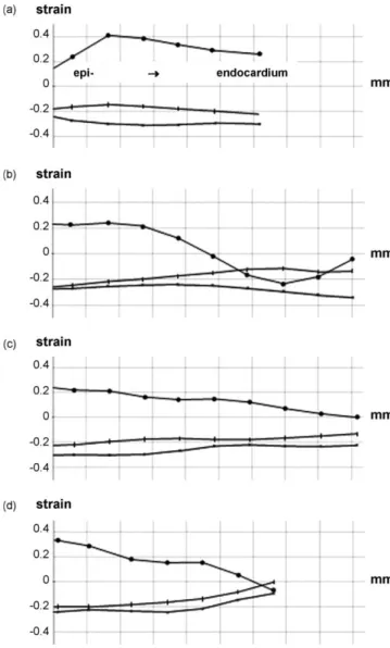 Fig. 4. Radial ( * , E RR ), circumferential ( , E CC ) and longitudinal (*, E LL ) components of strain in the (a) septal, (b) anterior, (c) lateral and (d) inferior wall of the basal area from epicardium (left) to endocardium (right) for the case f = 08