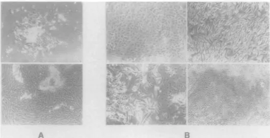 Fig. 1. Cell cultures from various tissues and culturing times. (A) Upper: cell culture NO-2-15056 10 days after initial seeding of the normal breast tissue.