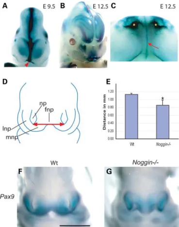 Figure 1. Noggin is expressed in the developing face and Noggin 2/2 mice exhibit a narrow frontonasal process