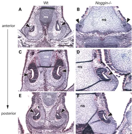 Figure 6. Abnormalities of the VO in Noggin 2/2 mice. (A– F) E16.5 hematoxylin and eosin stained frontal sections of WT and Noggin 2/2 heads showing the developing nasal septum and VO