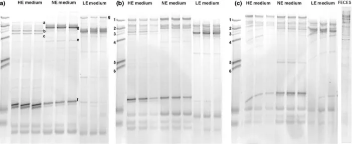 Fig. 2. TGGE profiles of fermentation model A during each nutrient load. (a) R1; (b) R2; (c) R3