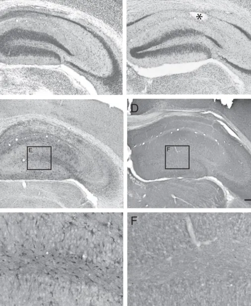 Fig. 6 Changes in hippocampal cytoarchitecture and ADK immunoreactivity 6 weeks after an intrahippocampal kainic acid injection.